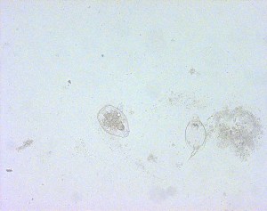 The structure on the left is a cyst-like structure of the rotifer (genus Philodina) pictured above. (The one on the right is another sort of rotifer, in genus Monostyla.)